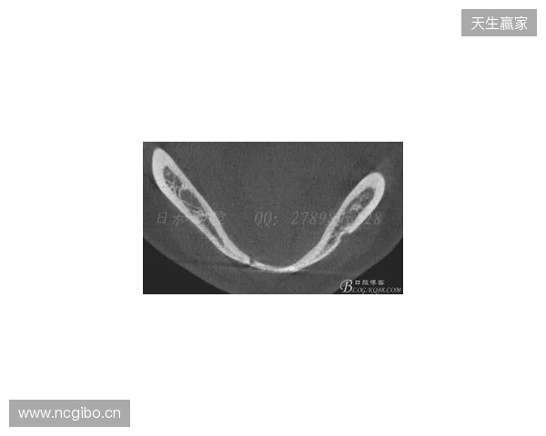 韦林顿确诊上唇部贯通伤；11、21牙半脱位；上颌前牙区牙槽骨骨折